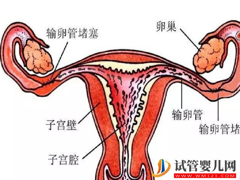 輸卵管堵塞致受孕困難很苦惱，試管嬰兒助孕當(dāng)真有效？(圖1)