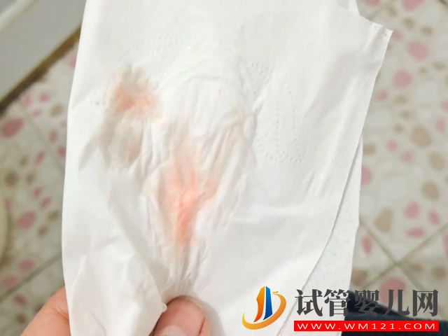 人工授精成功著床早期表現匯總，幫你更好的分辨是否懷孕！(圖3)