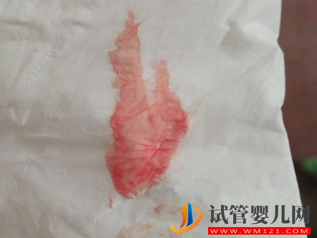 孕前一周內懷孕身體會有癥狀，通過該表現還能判斷是男是女(圖3)