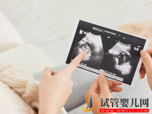 b超監測有卵黃囊基本是宮內妊娠，不管出現早晚都穩了(圖1)