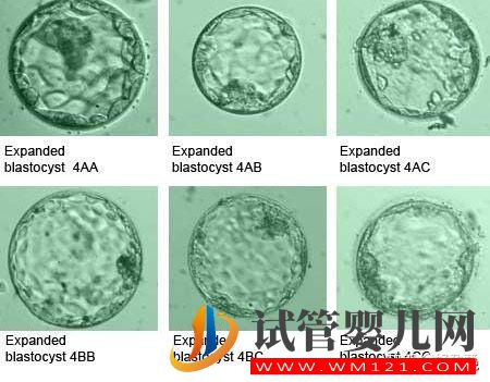 胚胎質(zhì)量好,移植卻頻頻失敗 什么原因造成？(圖1)