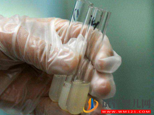 泰國試管hiv洗精術：價格雖高但相比國內有這3大優勢(圖1)