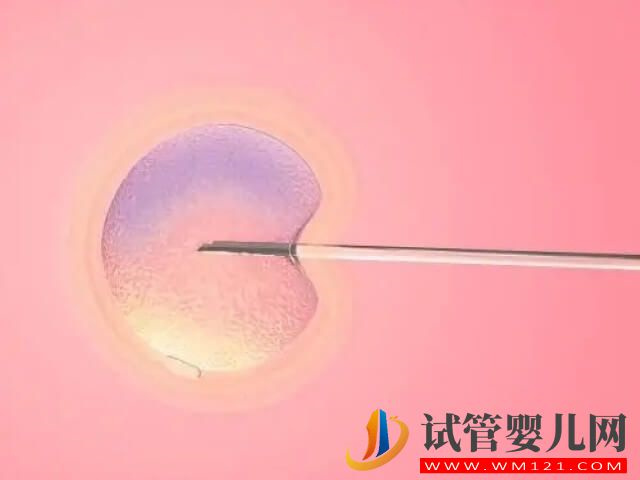 在湖州做一次試管嬰兒一代總共需要多少錢(qián)？(圖2)