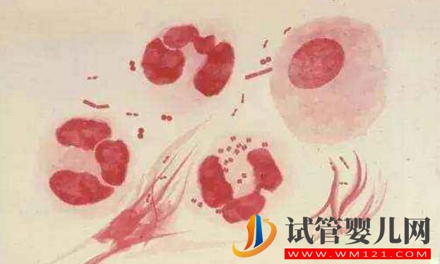 試管嬰兒前期檢查項(xiàng)目報(bào)告你看的懂嗎？看完就會了(圖5)