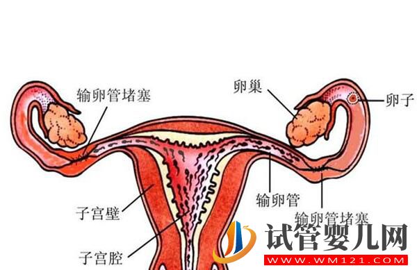 輸卵管積水會對試管嬰兒成功率造成影響嗎?(圖1) 輸卵管積水會對試管嬰兒成功率造成影響嗎?(圖1)