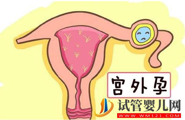 試管嬰兒會發(fā)生宮外孕嗎？到底能否避免呢(圖1)