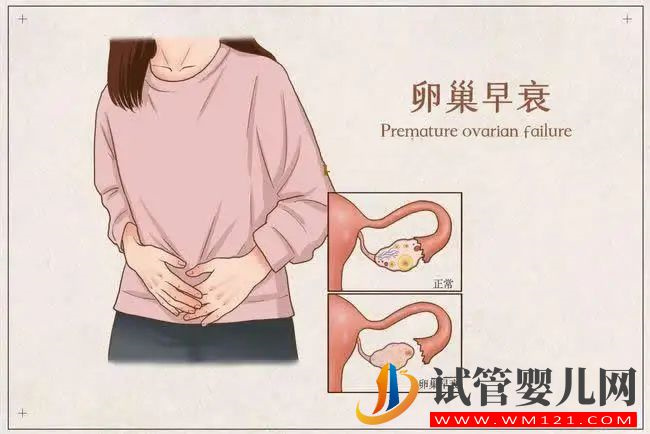 多囊卵巢如何科學(xué)備孕？(圖1)