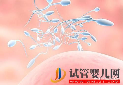 無精癥,需要進(jìn)行哪些檢查(圖2)