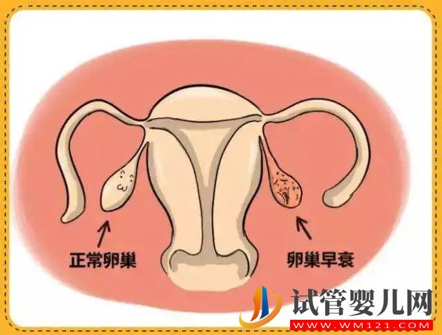 怎么看自己有沒有卵巢早衰(圖1)