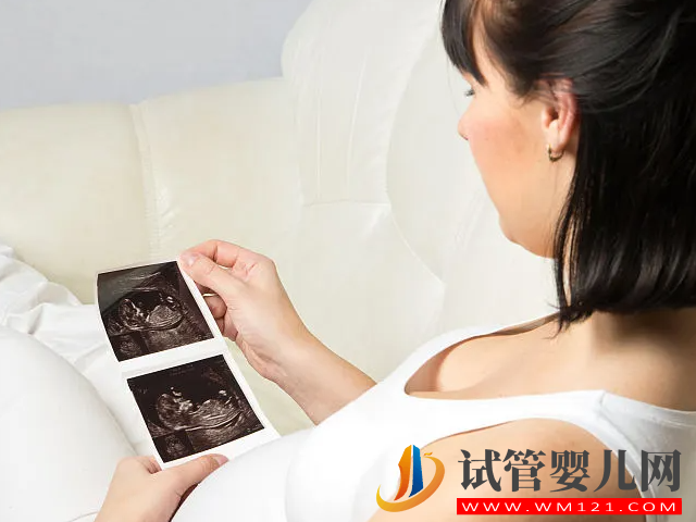 四維彩超男女參照圖對比，一看有這個特征是男寶幾率最大(圖1)