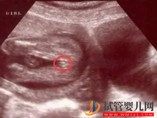 四維彩超男女參照圖對比，一看有這個特征是男寶幾率最大(圖2)