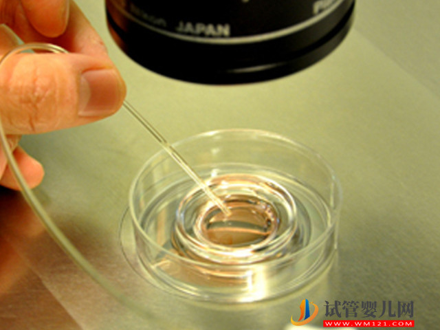 2023澳門人工授精最新價格表,“包成功”套餐全面解讀!(圖6) 2023澳門人工授精最新價格表,“包成功”套餐全面解讀!(圖6)