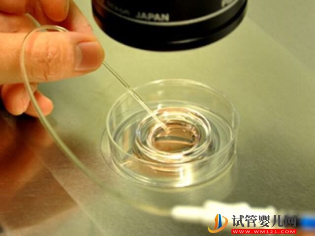 和田做試管嬰兒胚胎移植的成功率怎么樣？(圖2)