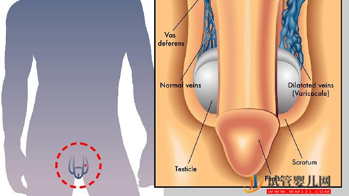 男性性功能障礙12個(gè)致病因素 五種水果能預(yù)防性功能障礙(圖3)