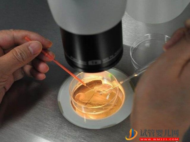 本溪試管5個(gè)鮮胚養(yǎng)囊一般可以成功幾個(gè)？(圖1)