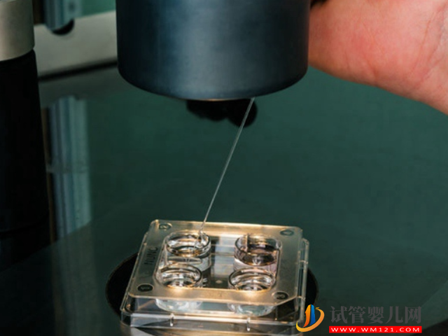 無(wú)精癥恢復(fù)生精功能并不困難，吃藥、手術(shù)都能有效解決(圖4)