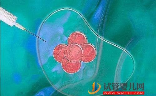 2023韓國試管嬰兒可以選擇性別嗎，選擇PGD技術即可(圖2)