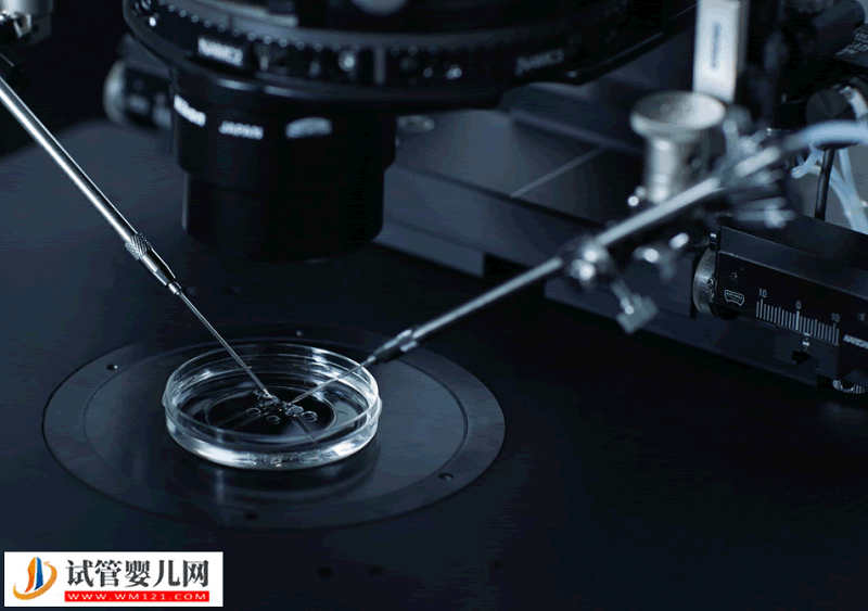 做試管嬰兒雌二醇多少算正常？(圖1)