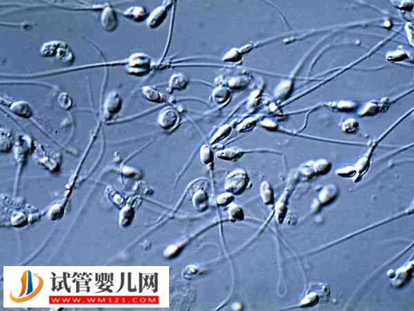 男性的精子活力達(dá)到多少才可以做二代試管嬰兒(圖2)