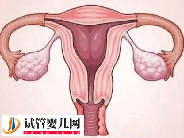 子宮切除后怎么保養(yǎng)比較好(圖4)
