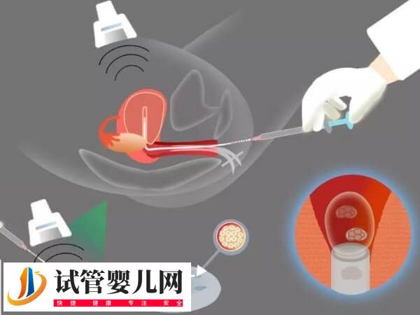 試管移植第四天出血是怎么回事