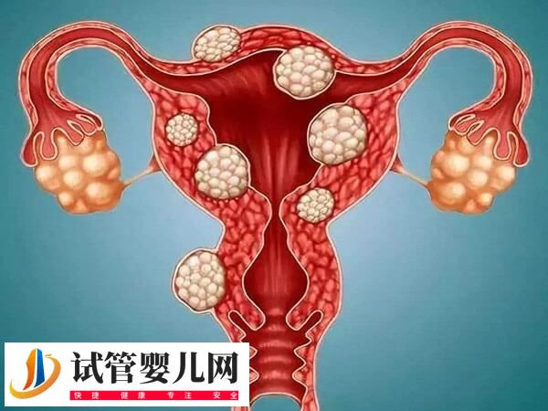 子宮切除手術危害大不大