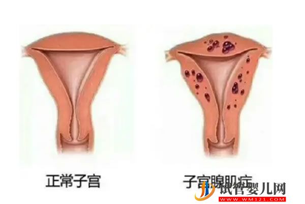 贛州寧都縣試管嬰兒多少錢，贛州寧都縣試管嬰兒多少錢一次 (圖1)